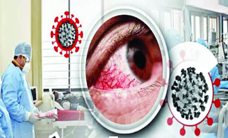 ব্ল্যাক ফাঙ্গাসে আক্রান্ত কি না বুঝবেন যেভাবে