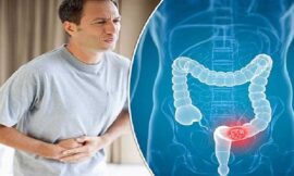 কোষ্ঠকাঠিন্য দূর করার সহজ কয়েকটি ঘরোয়া উপায়