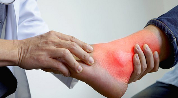 Read more about the article ইউরিক অ্যাসিড নিয়ন্ত্রণে রাখবে এই ৫টি ফল!